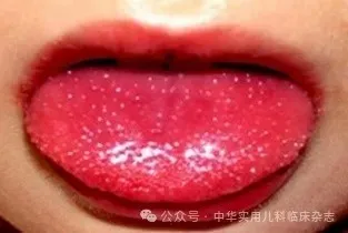 近期高发!无疫苗!这种传染病怎么防?-水母辟谣-水母网